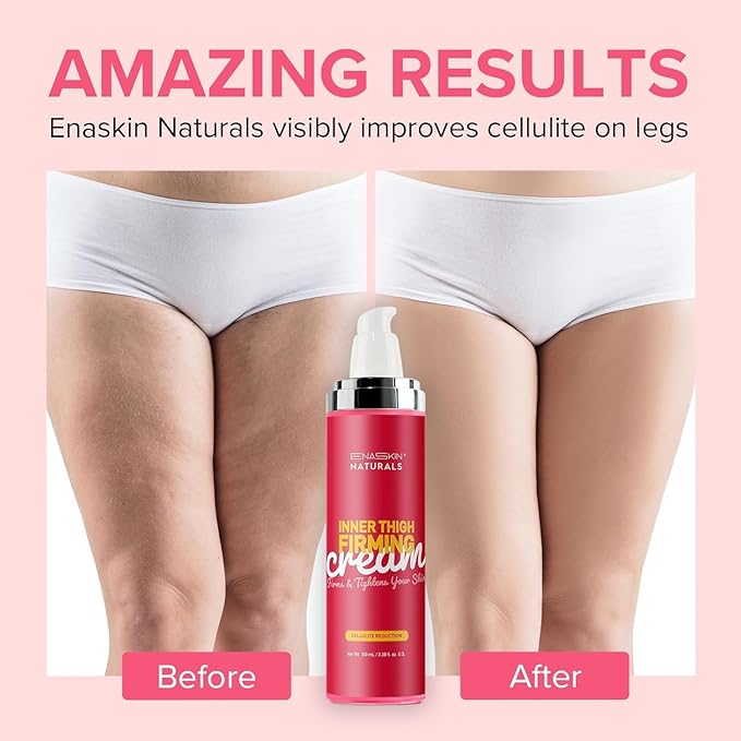 Enaskin Naturals Cellulite Remover for Legs & Anti Cellulite Cream - Skin Firming and Tightening Lotion for Inner Thigh ,Booty, Stomach & Belly, Body Firming Cream for Loose Skin, 100 ML